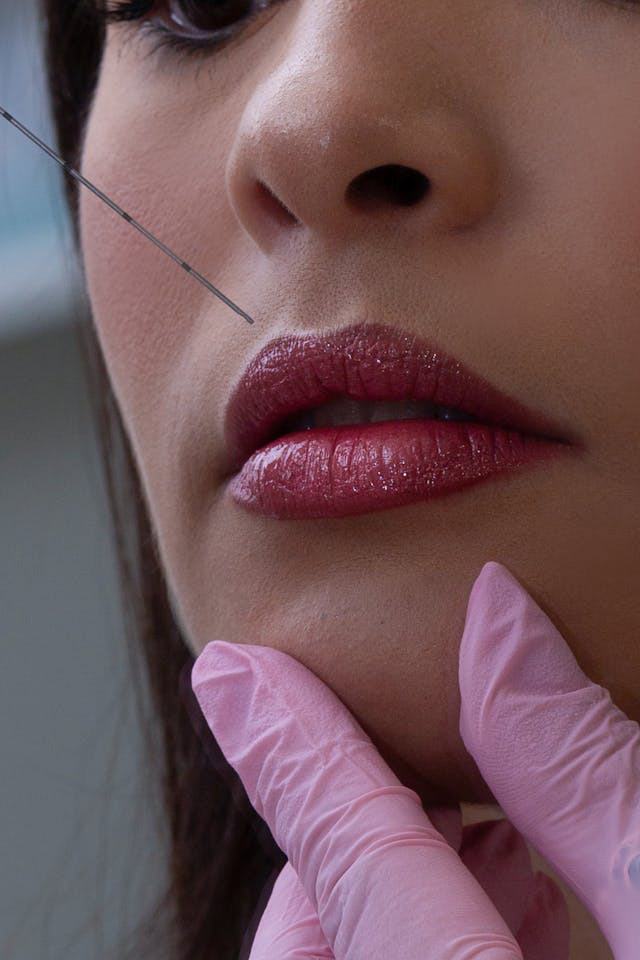Vos Besoins 3 Medecine esthetique thumb